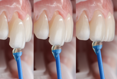 Formación Continua Facultad de Odontología UIC Barcelona - Restauradora