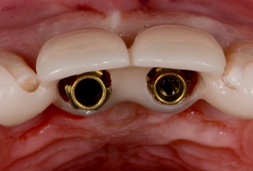 Formación Continua Facultad de Odontología UIC Barcelona - Odontopediatría